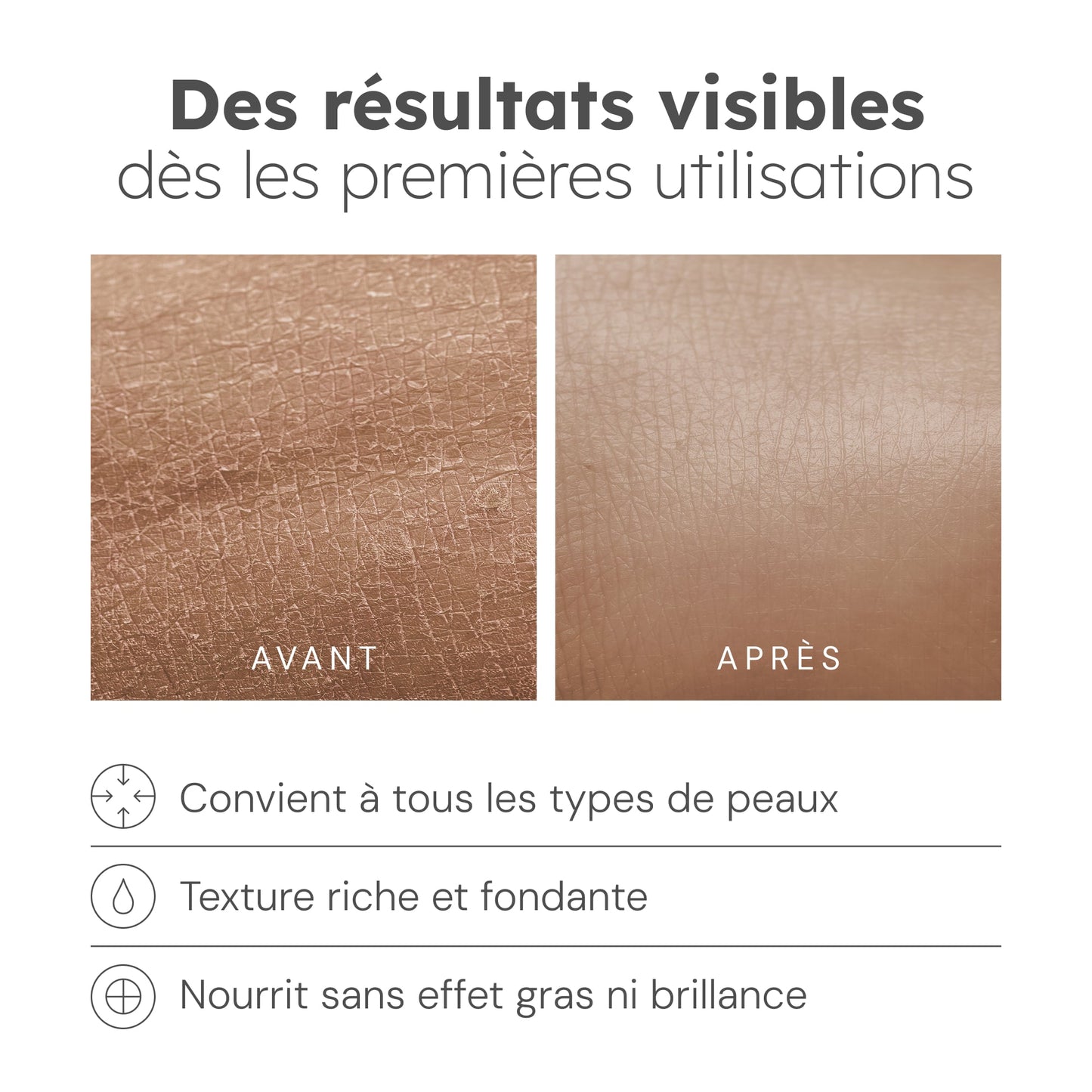 Feuchtigkeitsspendende Anti-Flecken-Creme – 50 g