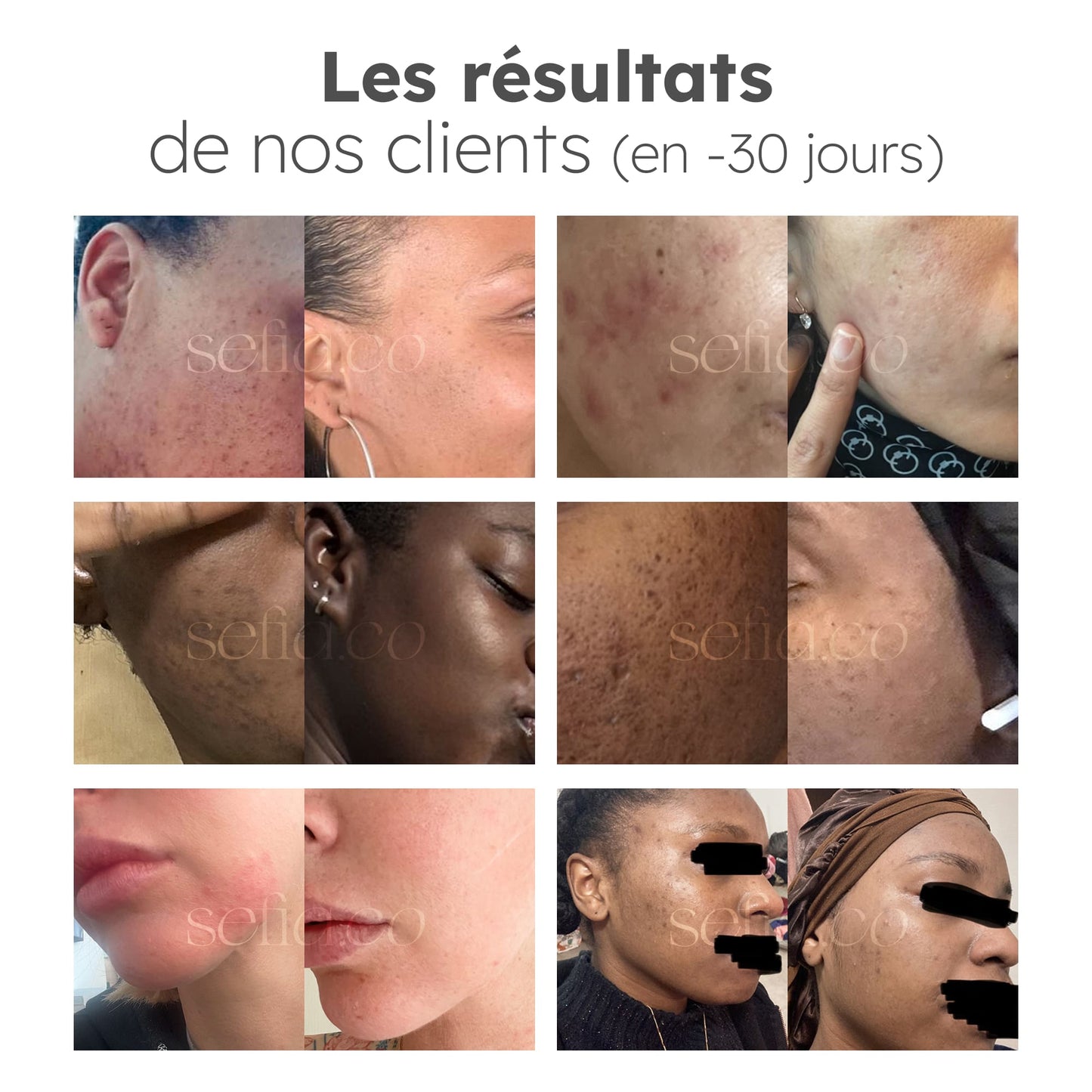 Super Glow - Routine 4 produits