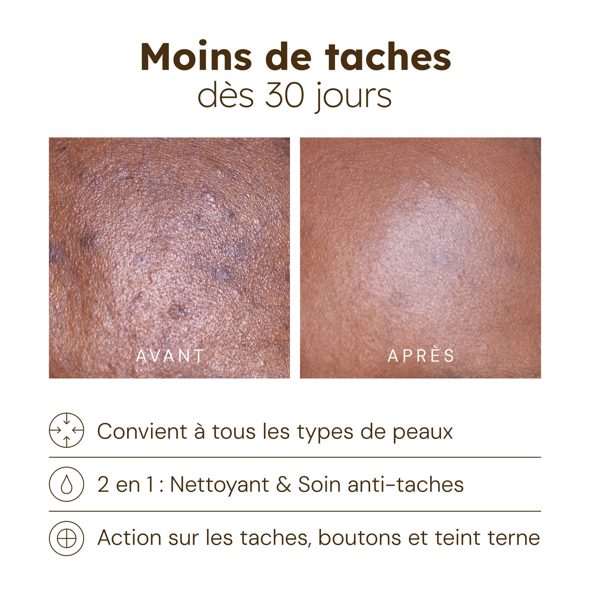 Reinigende Kurkuma- & Vitamin-C-Wattepads