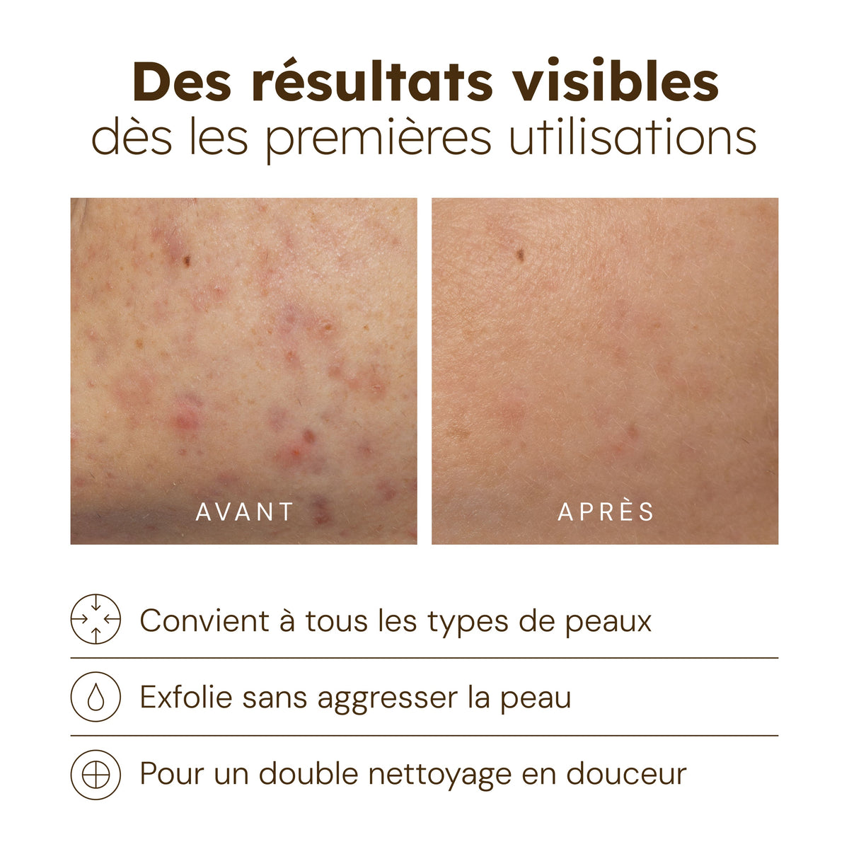 Kurkuma Glow-Reiniger – 100 ml